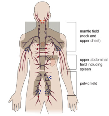 Radiation fields Radiation fields